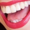 15 Natural Ways To Whiten Your Teeth Fast At Home