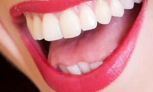 15 Natural Ways To Whiten Your Teeth Fast At Home
