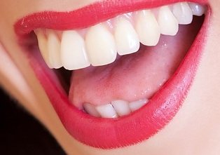 15 Natural Ways To Whiten Your Teeth Fast At Home
