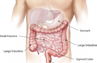 Detox The Body And Cleanse The Colon With These 10 Foods