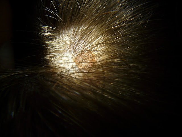 16 Foods That Stop Hair Loss: Hair Loss Diet