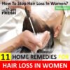 11 Home Remedies for Hair Loss in Women That Really Work