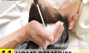 11 Home Remedies for Hair Loss in Women That Really Work