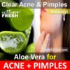How To Use Aloe Vera To Clear Acne Overnight Fast