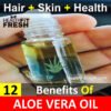 12 Best Benefits Of Aloe Vera Oil For Hair, Skin And Health