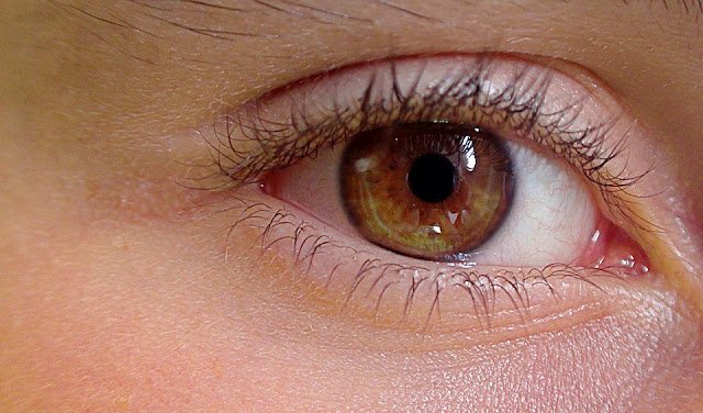 11 Safe & Effective Home Remedies for Cataract Removal