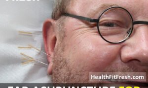 Ear Acupuncture For Weight Loss: How To Lose Weight With Ear Acupuncture