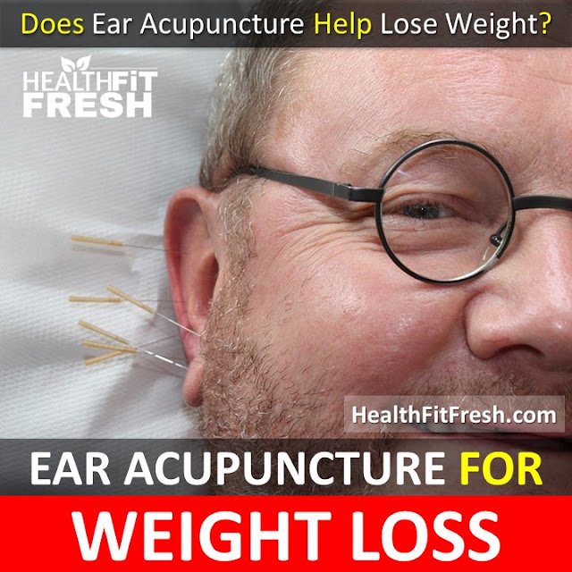 Ear Acupuncture For Weight Loss: How To Lose Weight With Ear Acupuncture