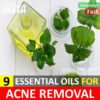 9 Powerful Essential Oils that Clear Acne Fast