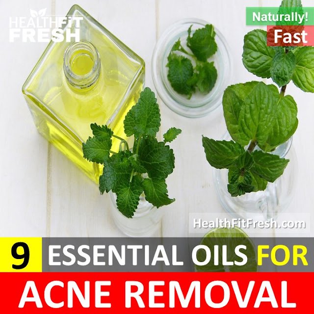 9 Powerful Essential Oils that Clear Acne Fast