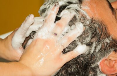 How To Prevent Pimples Due To Dandruff