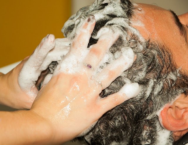 How To Prevent Pimples Due To Dandruff