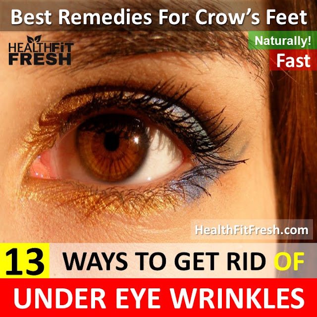 13 Ways to Get Rid of Under Eye Wrinkles (Crow’s Feet) Overnight Fast