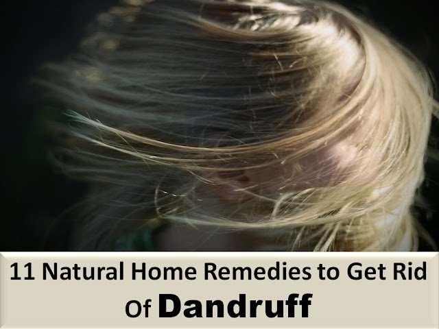 How To Get Rid Of Dandruff: 11 Remedies 11 Working Ways to Clear Dandruff Naturally Fast