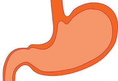 12 Best Ways to Get Rid of Gas and Bloating Fast