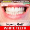 15 Natural Ways To Whiten Your Teeth Fast At Home