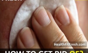 How to Get Rid of Pimples on Breast Overnight Fast