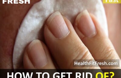 How to Get Rid of Pimples on Breast Overnight Fast