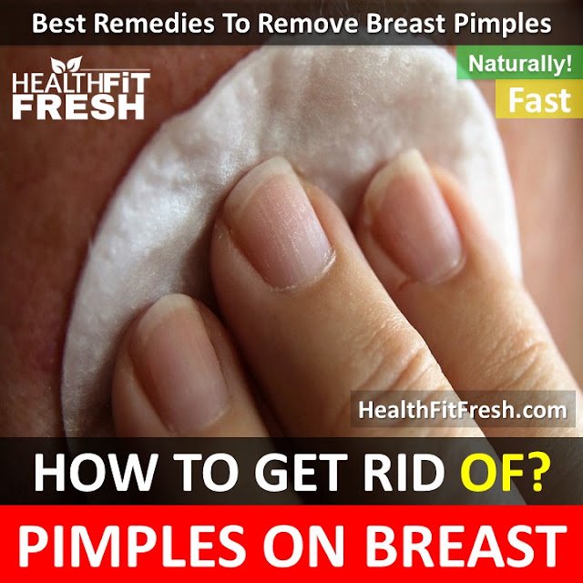 How to Get Rid of Pimples on Breast Overnight Fast