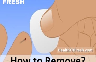 10 Home Remedies to Remove a Splinter Safely Without Pain