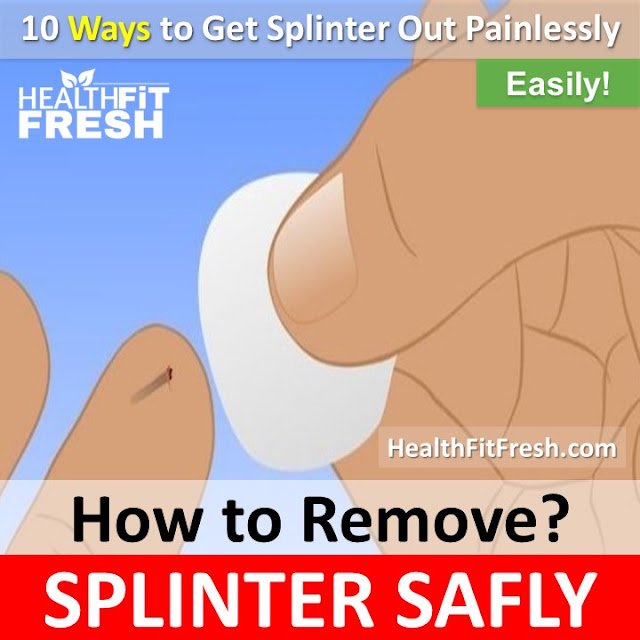 10 Home Remedies to Remove a Splinter Safely Without Pain