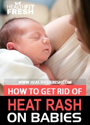 How To Get Rid Of Heat Rash On Babies How To Get Rid Of Heat Rash On Babies